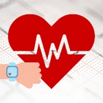 Heart Rhythm