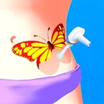 Tattoo Removal