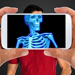 XRAY image filtering